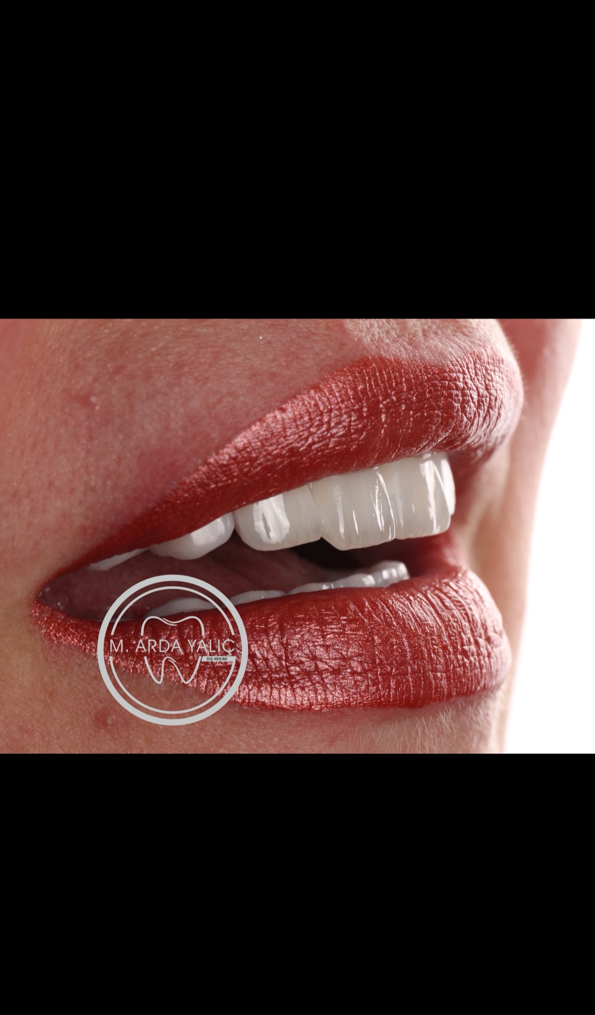 Dental treatment before and after result 07