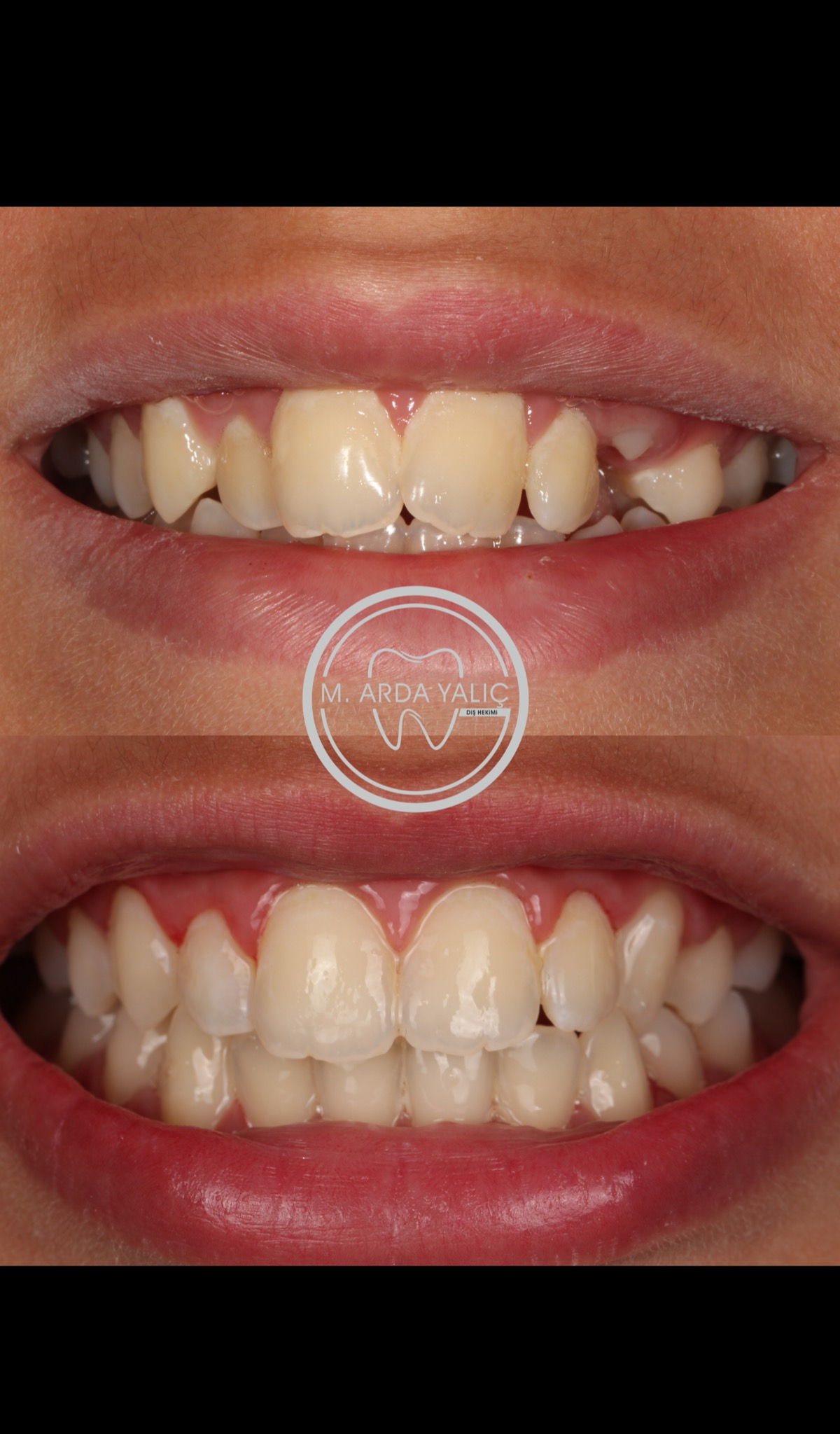 Dental treatment before and after result 09