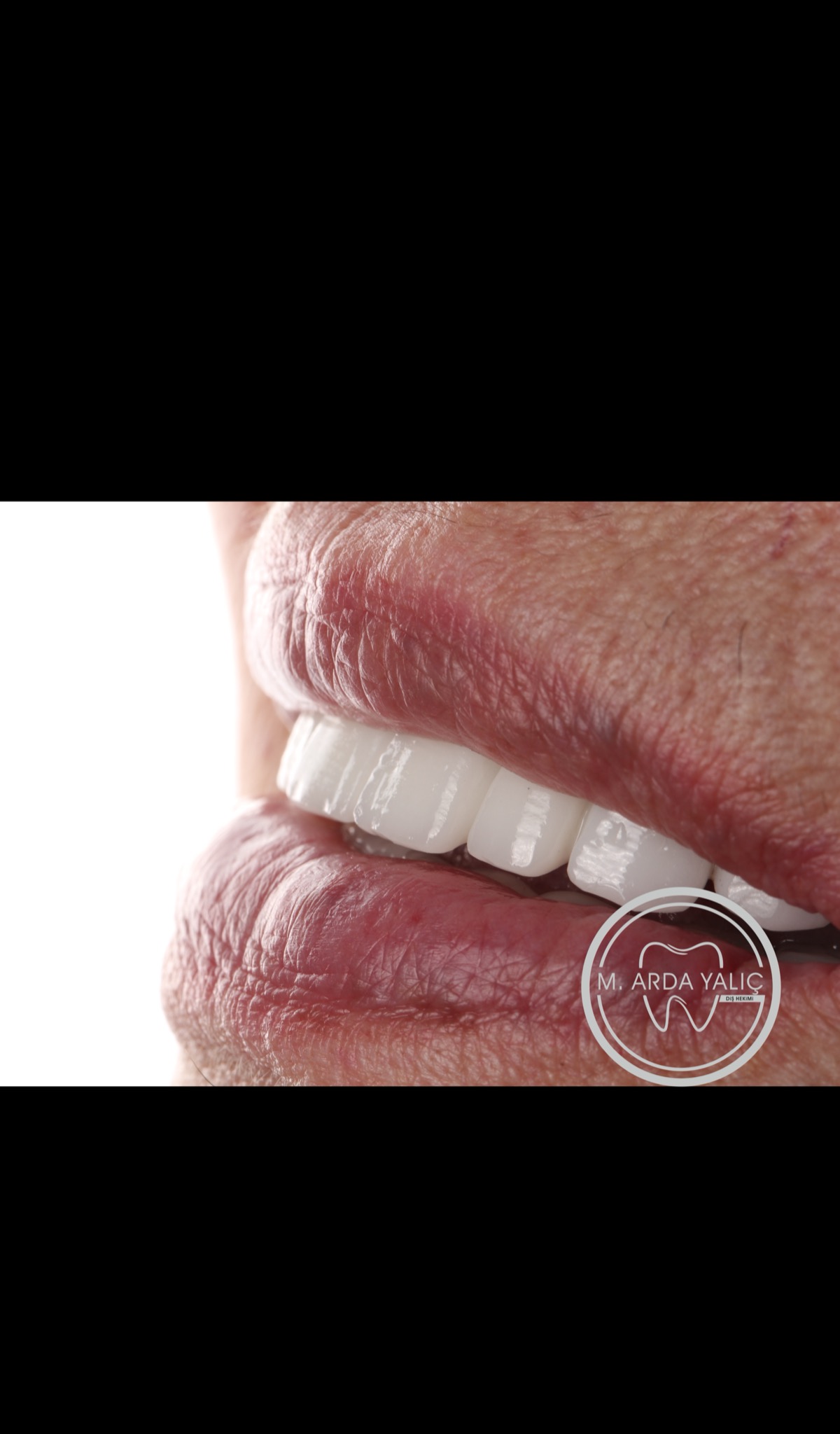 Dental treatment before and after result 11