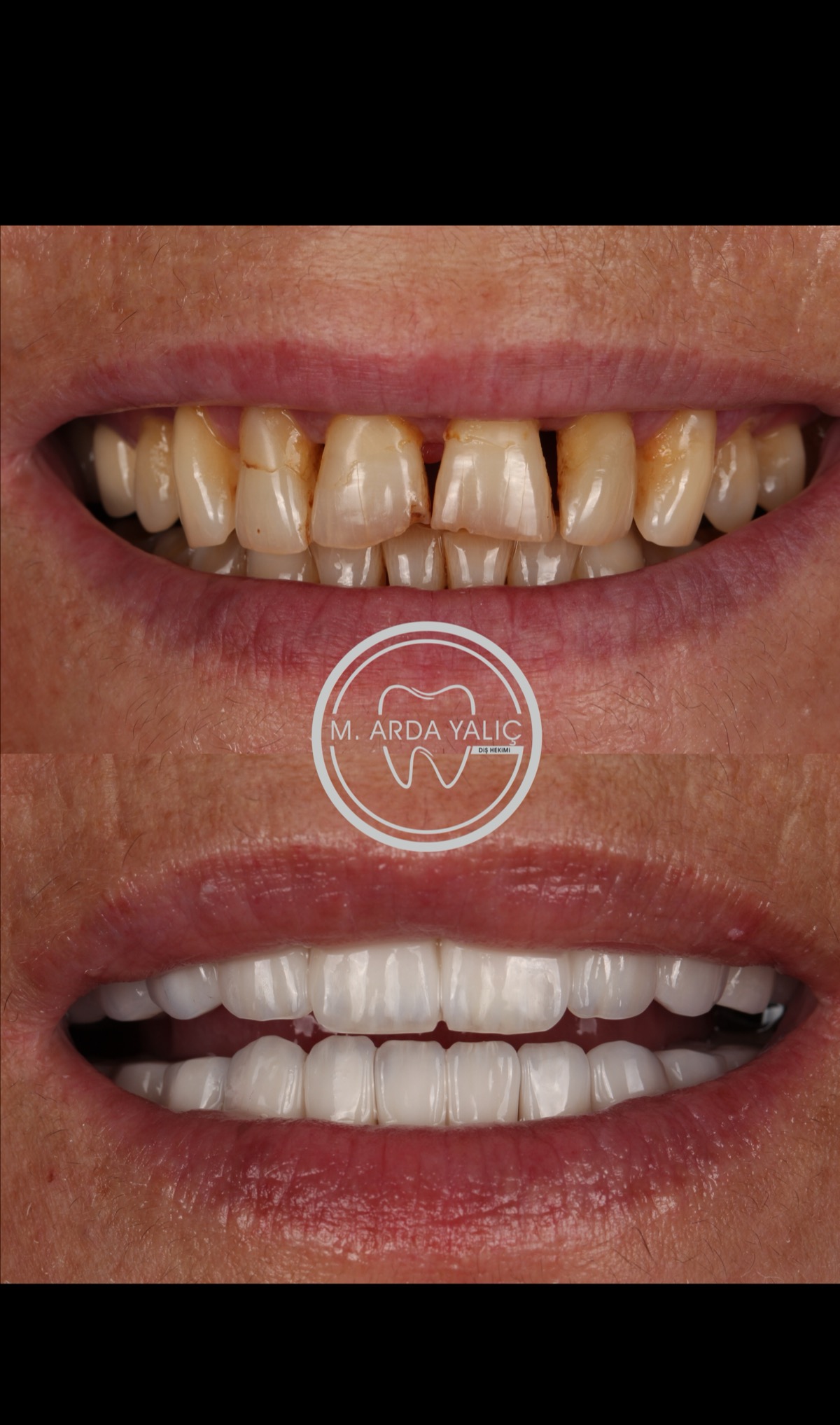 Dental treatment before and after result 18