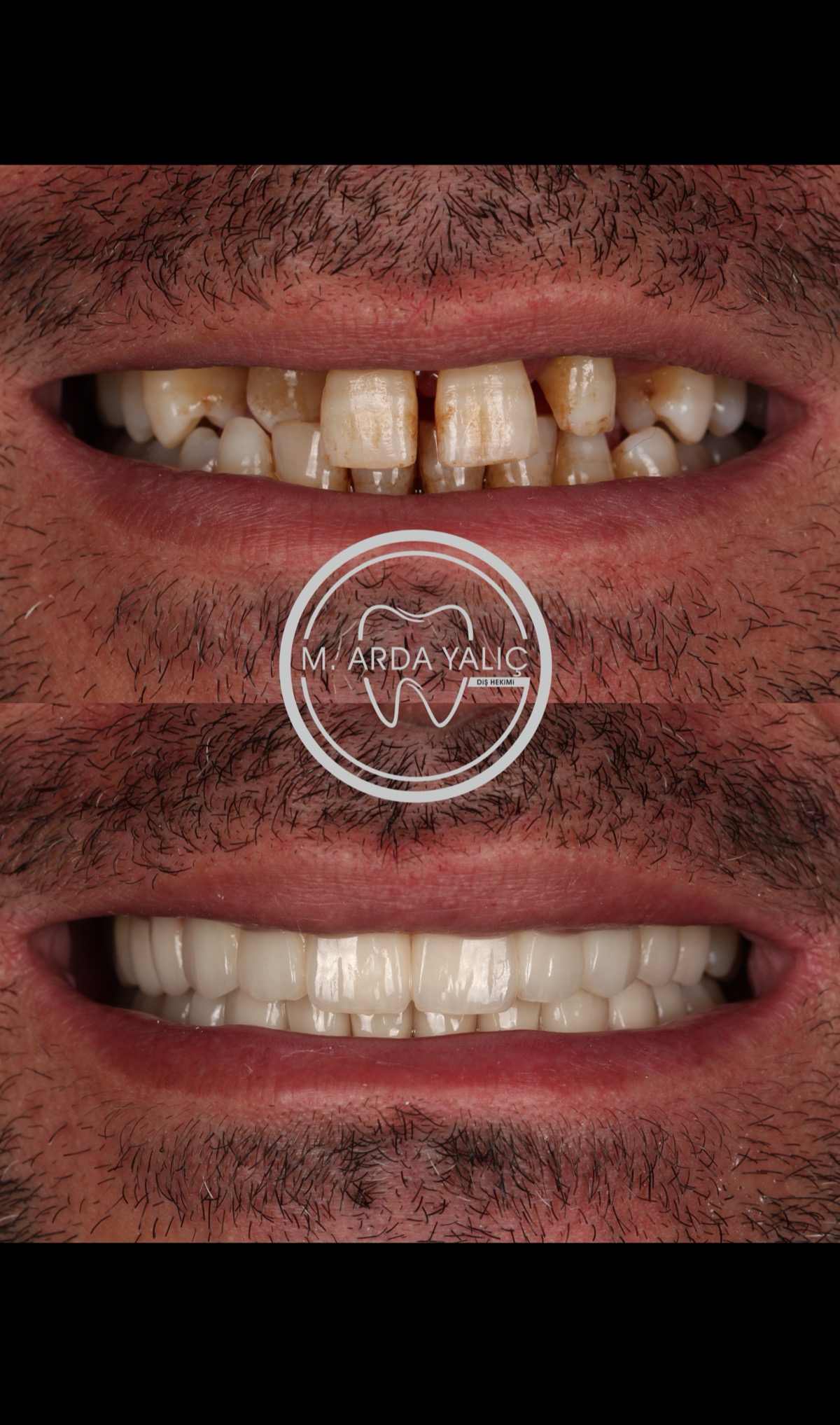 Dental treatment before and after result 21