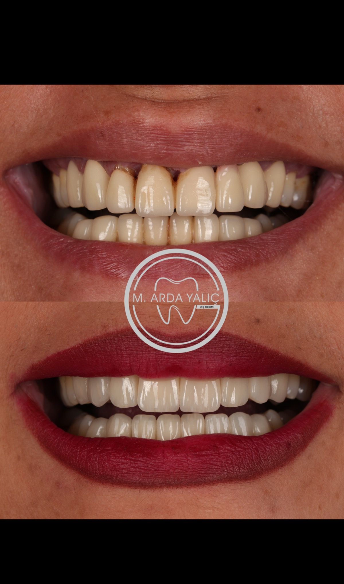 Dental treatment before and after result 22