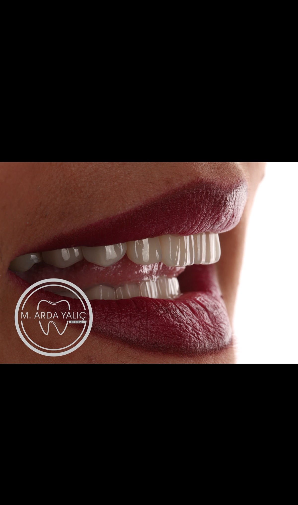 Dental treatment before and after result 23