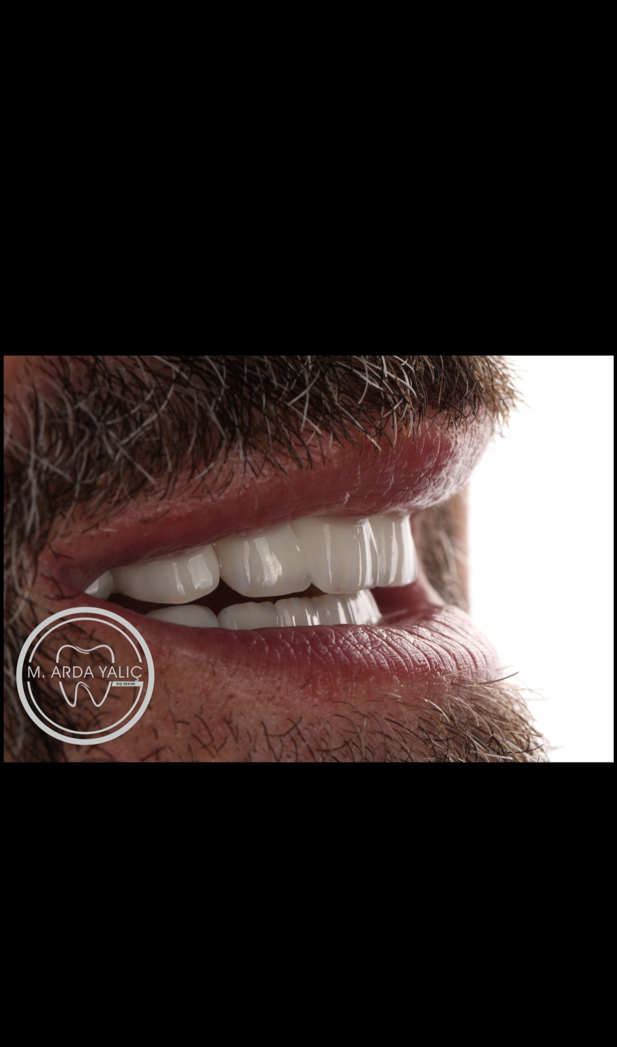 Dental treatment before and after result 26