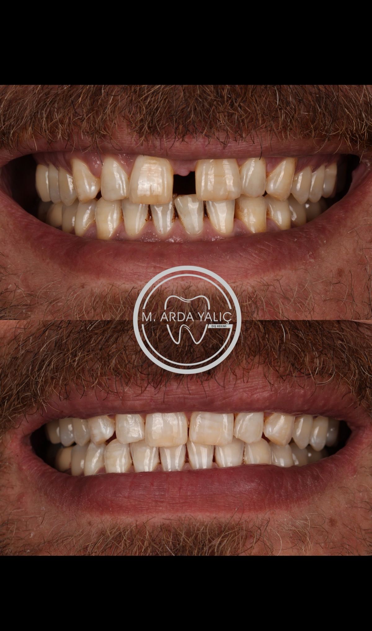 Dental treatment before and after result 27