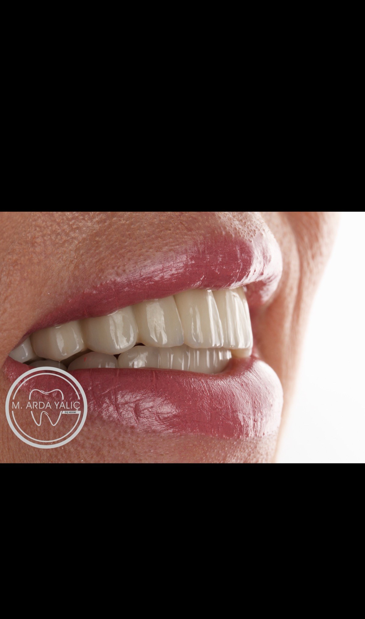 Dental treatment before and after result 29